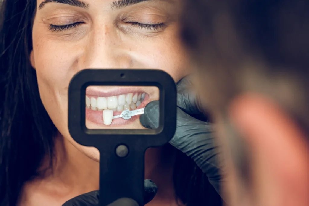 Dentist in Kingsburg CA, Dental Implants and Cosmetic Dentistry 93631|Teeth Whitening/cleaning