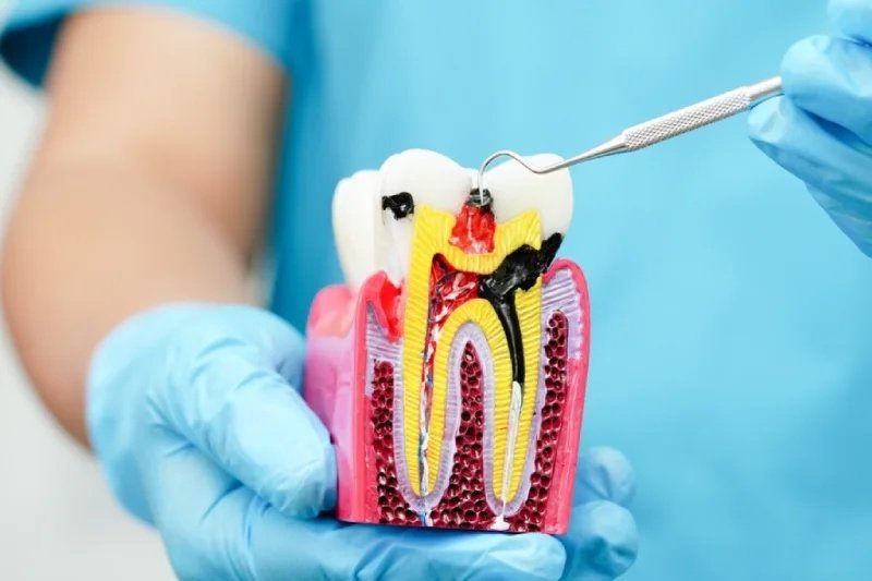 Dentist in Kingsburg CA, Dental Implants and Cosmetic Dentistry 93631|Simple Extractions