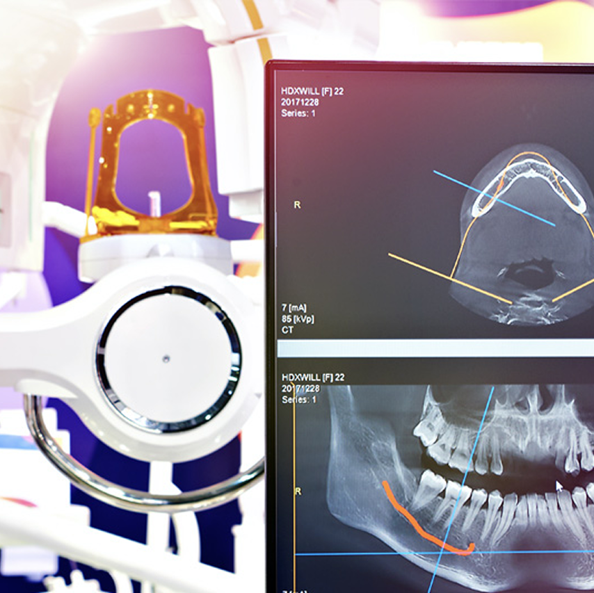 Digital_X-Rays