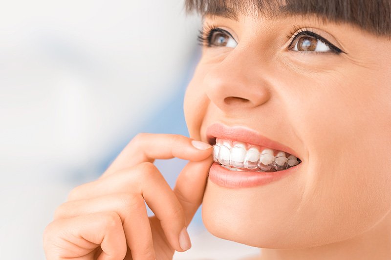 Dentist in Kingsburg CA, Dental Implants and Cosmetic Dentistry 93631|Invisalign