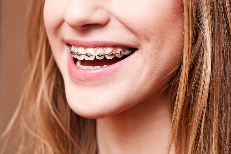 Dentist in Kingsburg CA, Dental Implants and Cosmetic Dentistry 93631|Orthodontics