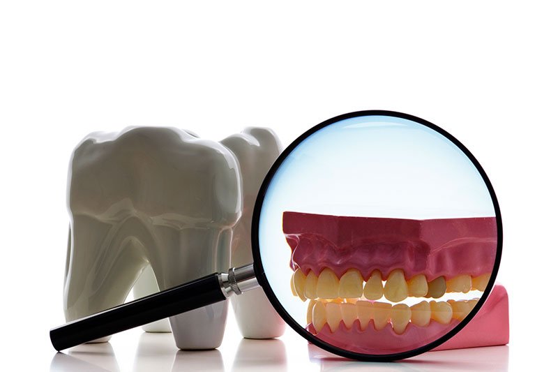 Dentist in Kingsburg CA, Dental Implants and Cosmetic Dentistry 93631|Root Canal