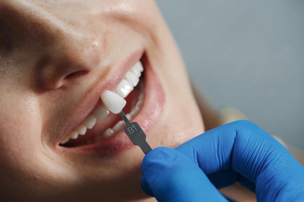 Affordable Dental Implants